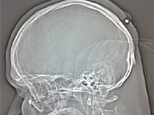 Фото новости